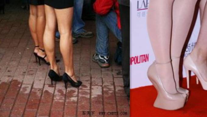 如何让扁平足拥有足弓,扁平足跑起来有足弓