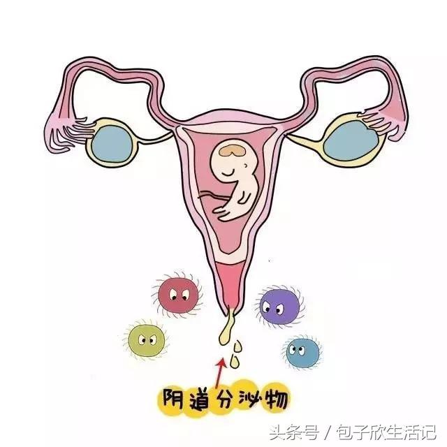 孕期分泌物多还有炎症怎么办,孕期分泌物比较多是什么原因