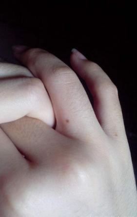 女人右手手背突然长痣代表什么,女人左手手背上有颗痣