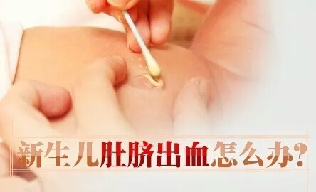 新生宝宝肚脐出血结痂要清洗吗,脐带脱落脐部有出血