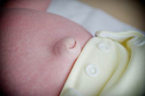 新生宝宝肚脐出血结痂要清洗吗,脐带脱落脐部有出血