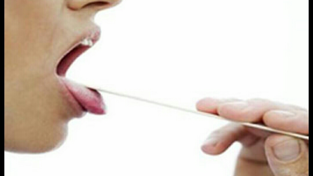 引起口苦的药,引起口苦的祸根