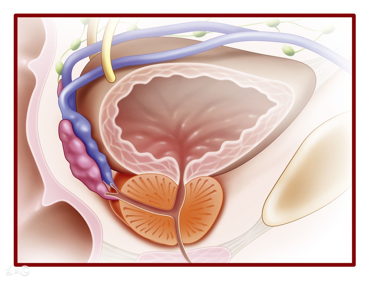 膀胱腹膜外破裂多久自愈,腹膜内型膀胱破裂名词解释