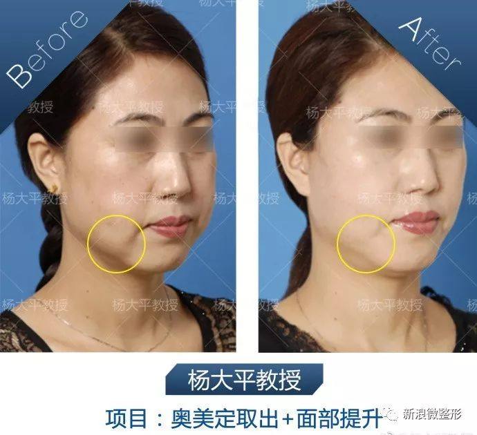 又到周四案例时间!快来看看这期有没有你想做的项目~