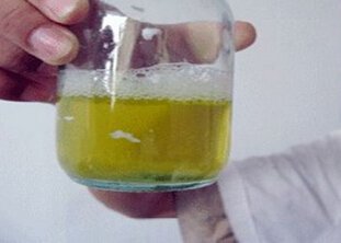 晨起第一泡尿泡沫多,早晨第一泡尿泡沫不散