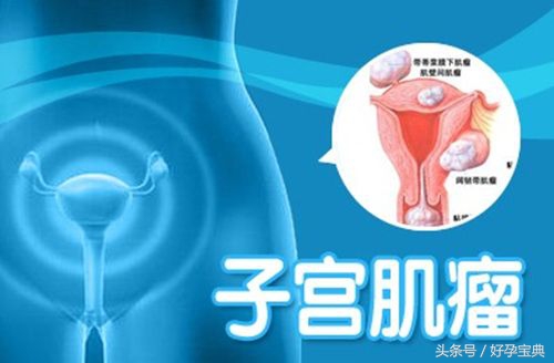 为什么宫腔会发生改变？宫腔改变为什么会导致不孕不育？
