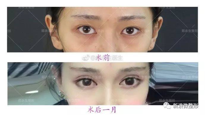 又到周四案例时间!快来看看这期有没有你想做的项目~