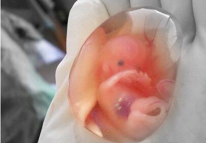 怀孕早期有点出血吃什么药能保胎,早期怀孕出血保胎吃什么药