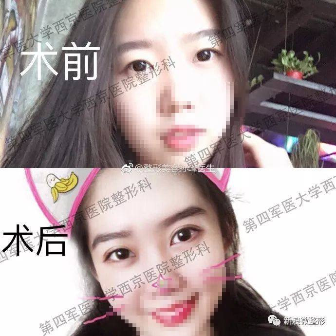 又到周四案例时间!快来看看这期有没有你想做的项目~