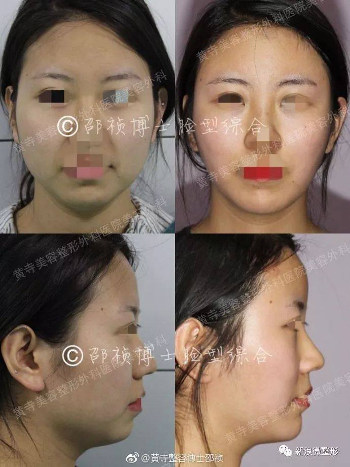 又到周四案例时间!快来看看这期有没有你想做的项目~