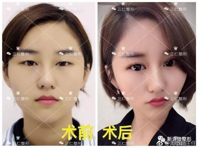 又到周四案例时间!快来看看这期有没有你想做的项目~