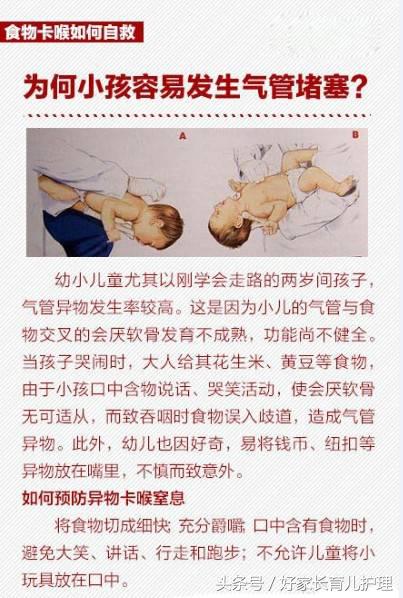 桂圆卡住喉咙致死,被桂圆卡喉咙急救法