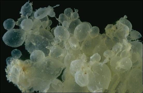 怀孕五个月了肚子比别人大啥原因,怀孕5个月了肚子比一般人要大