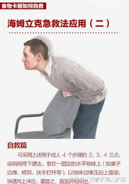 桂圆卡住喉咙致死,被桂圆卡喉咙急救法