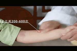 小儿上火便秘推拿动态图,便秘小儿推拿病历