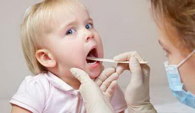 宝宝急性扁桃体炎有什么症状,急性喉炎和扁桃体炎的症状