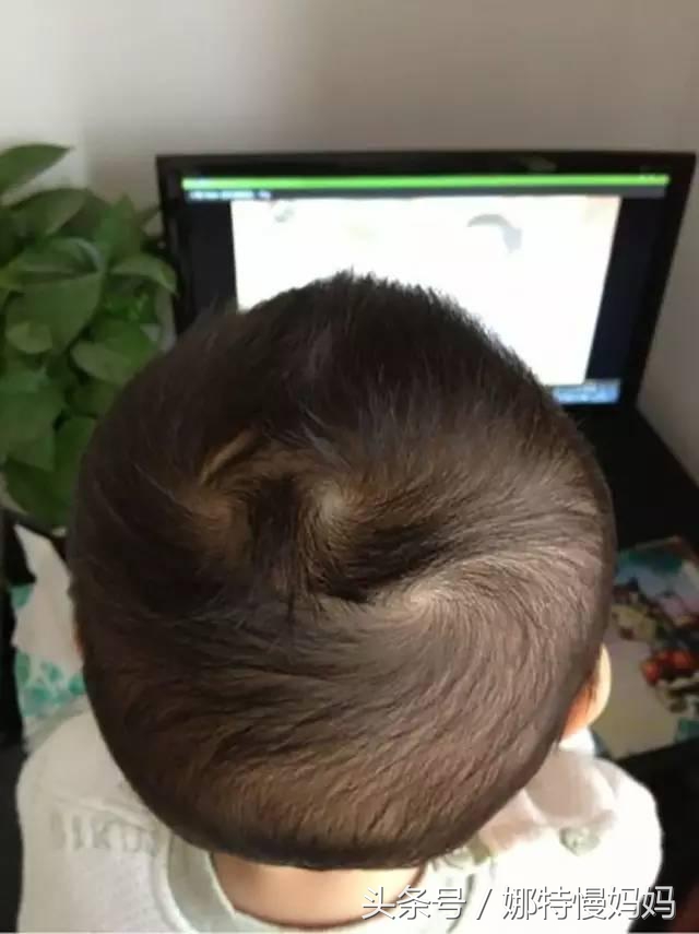 宝宝头旋歪了有啥说法,宝宝有两个头旋有什么说法