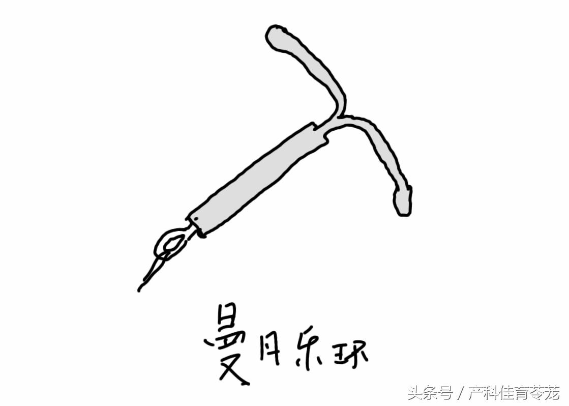 上环15天后还用避孕吗,上环前你应该详细了解这些知识