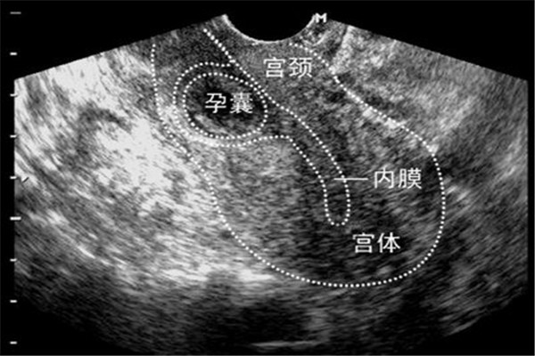 多次试管婴儿失败,多次试管婴儿不成功是什么原因