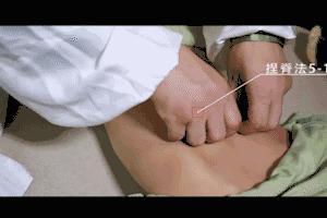 小儿上火便秘推拿动态图,便秘小儿推拿病历