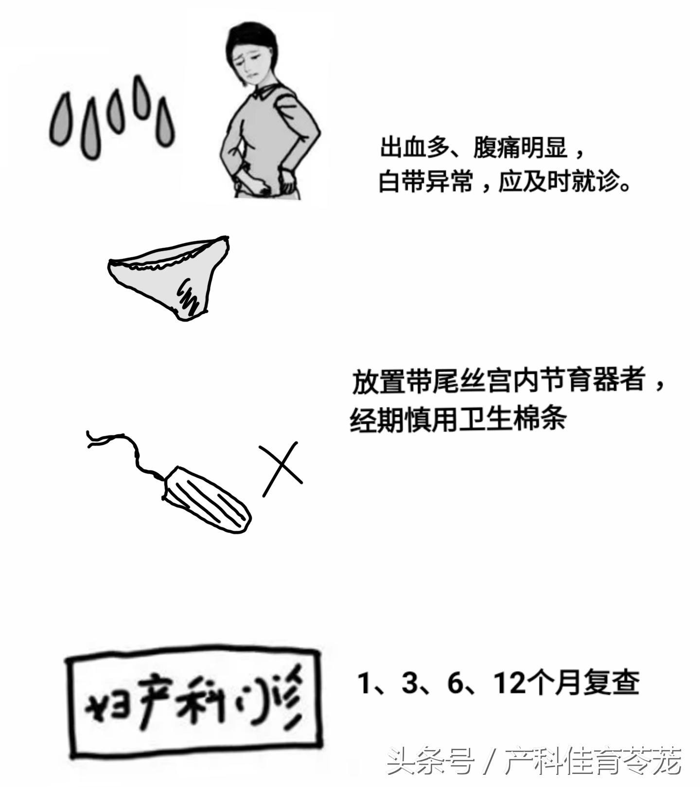 上环15天后还用避孕吗,上环前你应该详细了解这些知识