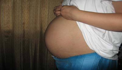 产道损伤是怎么回事?