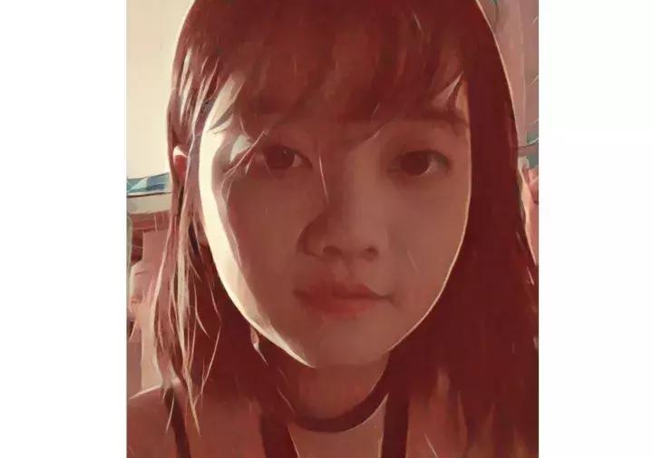 整容失败后的样貌,整容失败后才觉得自己没有丑