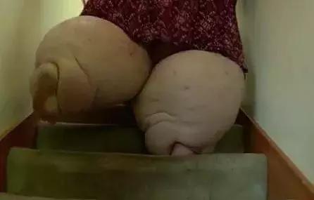 突围肥胖！肥胖杀死你的七种*器武**！