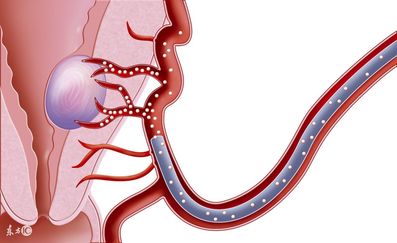 女性最大的私密问题，你还敢忽略吗？