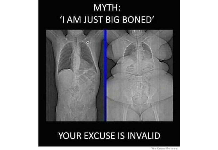 判断你是胖还是骨架大,是不是骨架大的人更容易胖