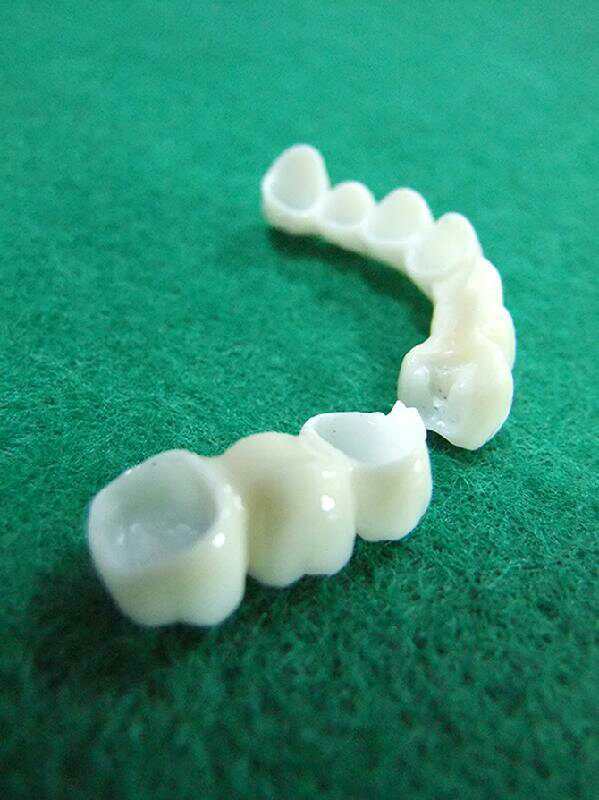 3d打印金属烤瓷制作流程与标准,3d打印氧化锆全瓷牙制作