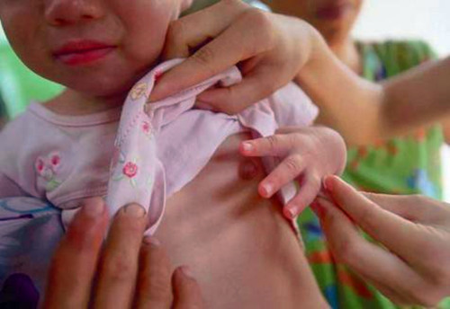 妈妈们不必惊慌新生儿的常见症状,1-30天新生儿常见问题