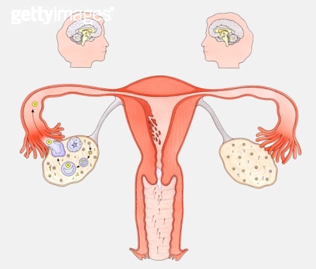 卵巢囊肿你了解多少？
