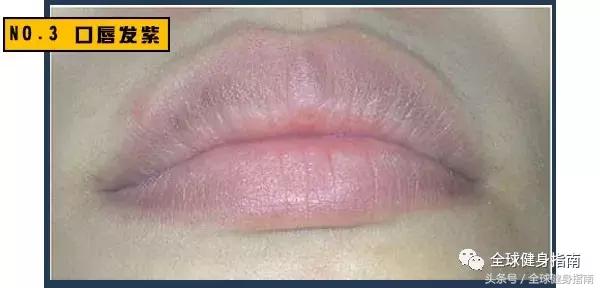 俄罗斯模特猝死尸检,20多岁俄罗斯超模跳楼事件