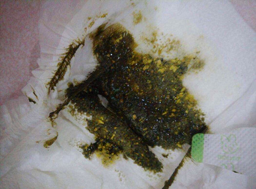 妈妈们不必惊慌新生儿的常见症状,1-30天新生儿常见问题