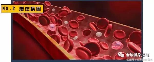 俄罗斯模特猝死尸检,20多岁俄罗斯超模跳楼事件