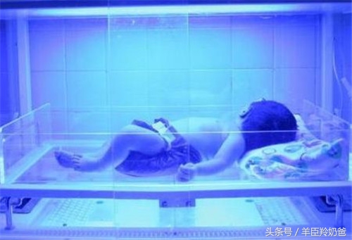 新生儿黄疸病理性和生理性区别,怎么判断新生儿黄疸是病理性黄疸