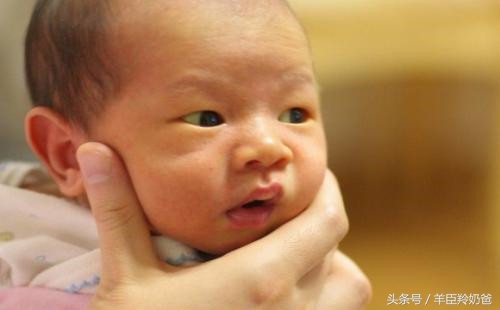 新生儿黄疸病理性和生理性区别,怎么判断新生儿黄疸是病理性黄疸