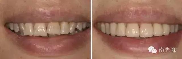 美容冠美白,一周快速脸部美白小妙招