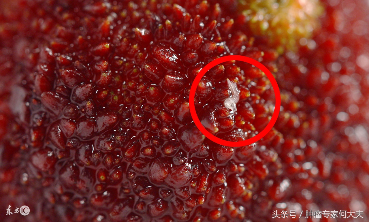 抗癌第一名中药斑蝥,治肝癌的斑蝥药方