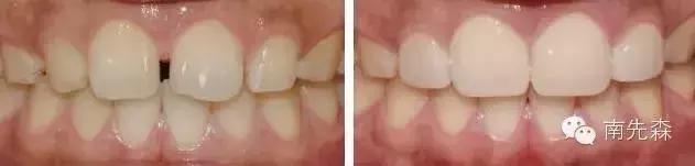 美容冠美白,一周快速脸部美白小妙招