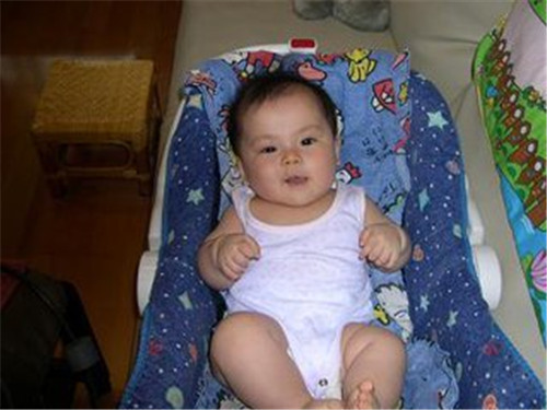 新生儿脚内翻怎么判断严重,新生儿脚内翻有什么方法矫正