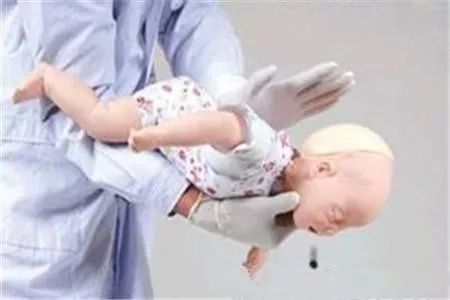 6个月宝宝有痰拍x光片,宝宝咳痰咳不出怎么办