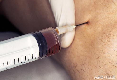 膝盖疼痛的原因和解决方法,膝盖上下楼疼痛的原因和解决方法