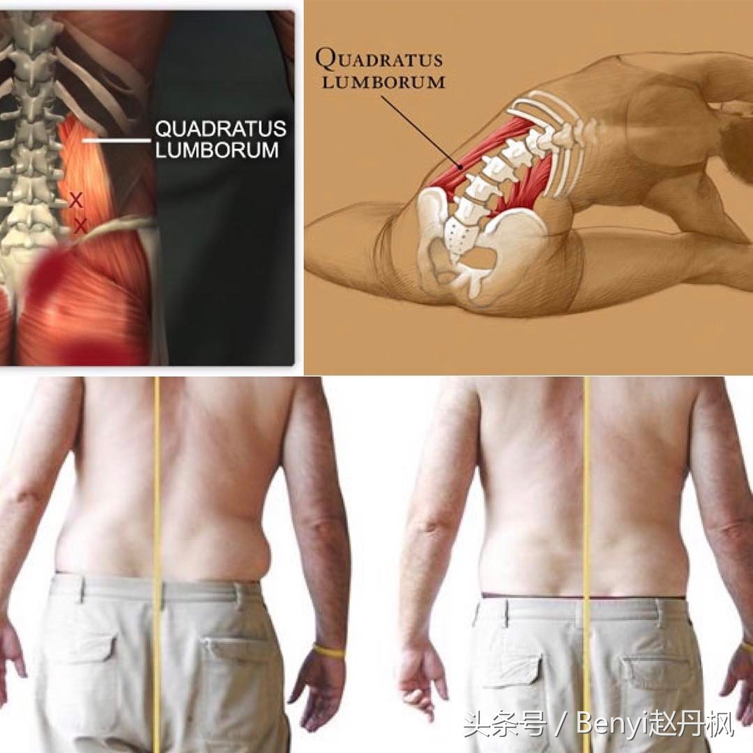 减缓腰椎疼痛的药,减缓腰椎间盘突出疼痛的按摩手法