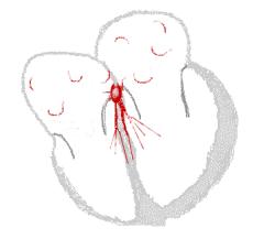 心脏房颤中医能治疗吗,老年心脏房颤吃什么药