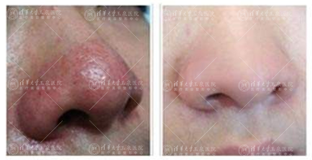 为啥你是西方的玫瑰却是东方的*疮痤**