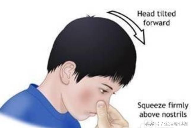 流鼻血正确止血方法,流鼻血的正确止血方法姿势