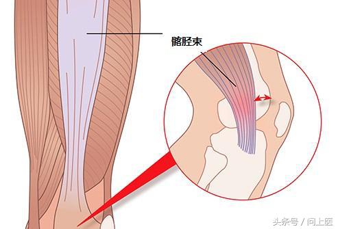 膝盖疼痛的原因和解决方法,膝盖上下楼疼痛的原因和解决方法