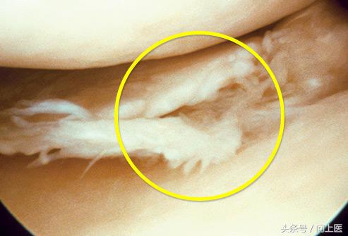 膝盖疼痛的原因和解决方法,膝盖上下楼疼痛的原因和解决方法